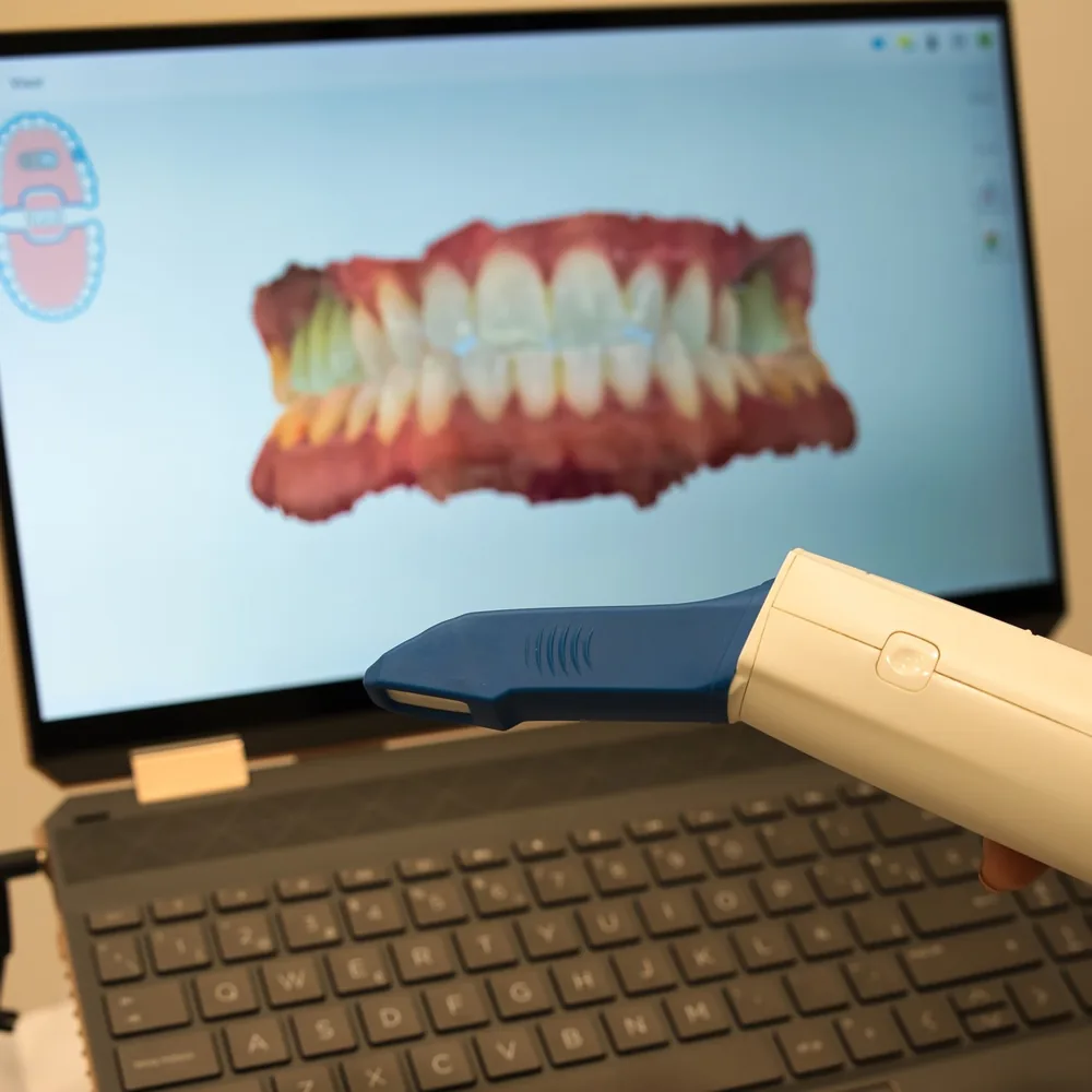Equipo de Lobato Dental asesorando a un paciente