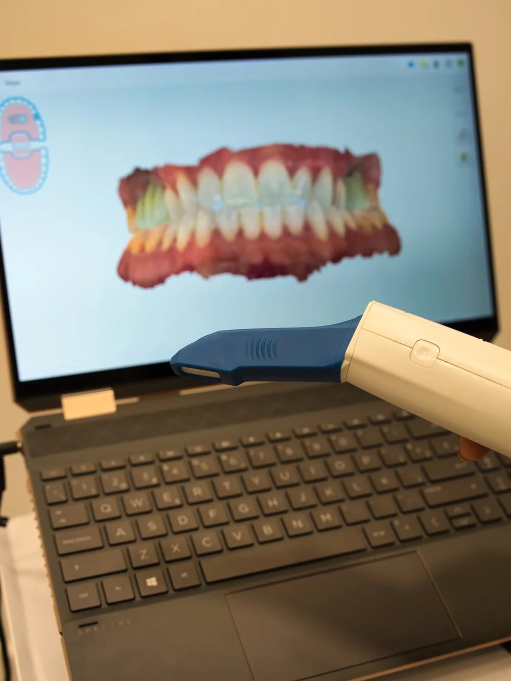 Radiografía 3D de implante dental